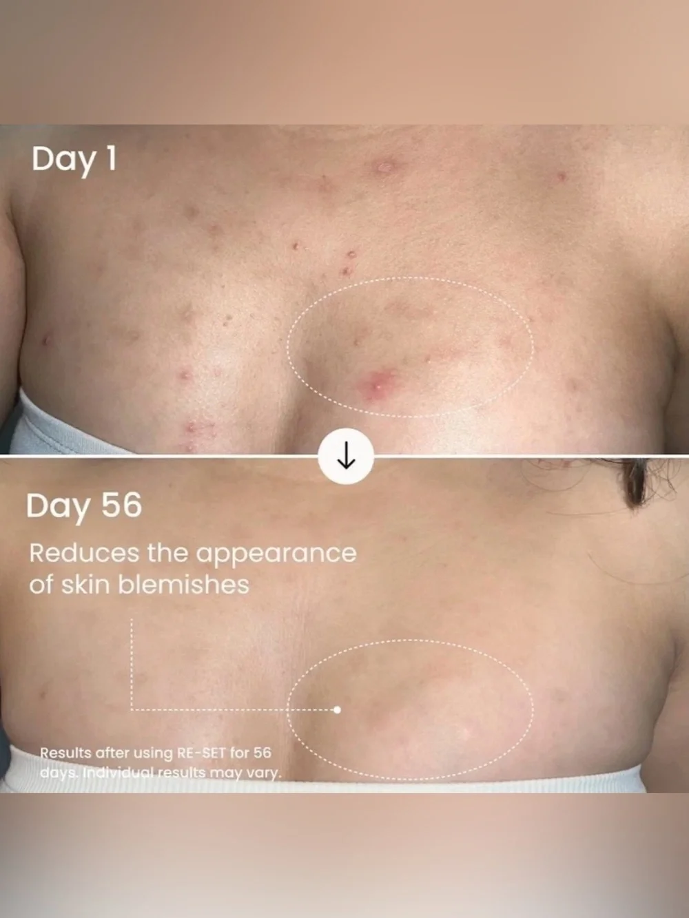 RE-SET Balancing Body Serum — 3.5 oz